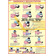 Emergency Resuscitation-vcp