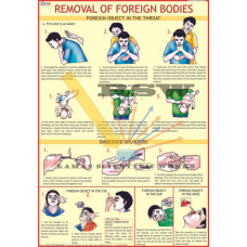 Removal of Foreign Bodies from Eye, Ear & Nose-vcp