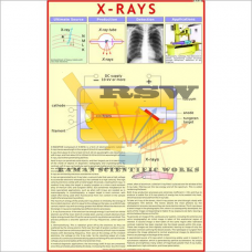 X-Ray-vcp