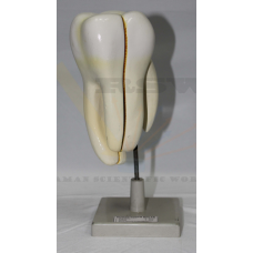 Human Tooth on Stand